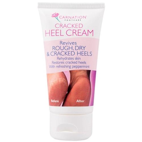 Vican Carnation Footcare Cracked Heel Cream Κρέμα Αναζωογόνησης για Άγριες, Ξηρές & Ταλαιπωρημένες Πτέρνες με Έλαιο Μέντας 50ml